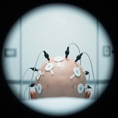Close-up of electrodes on a patient's head during an evoked potential test
